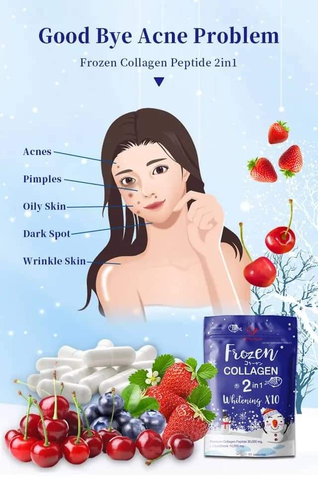 Frozen Collagen